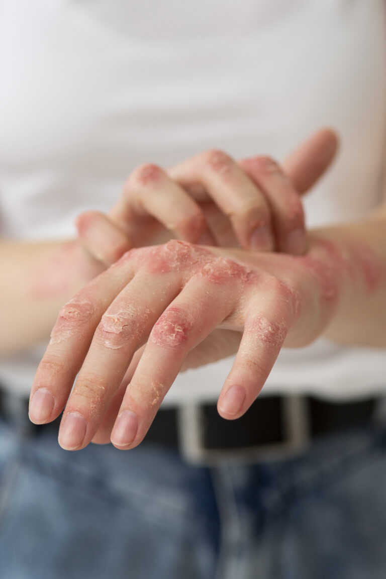 Are you suffering from allergies or just an autoimmune disorder? Understand the facts before seeking proper care.